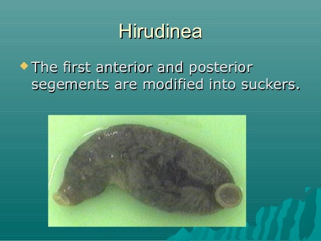 Class Hirudinea Notes