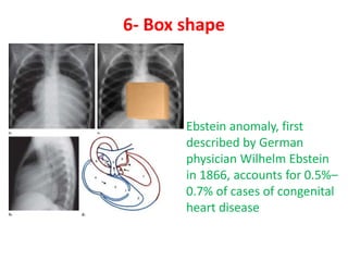 Classical cong.h disease 5th power point presentation (3) | PPTX