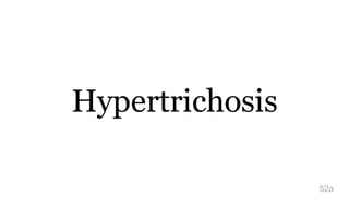 Hypertrichosis
52a
 