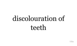 discolouration of
teeth
120a
 