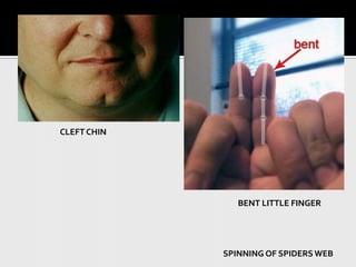 CLEFT CHINBENT LITTLE FINGERSPINNING OF SPIDERS WEB