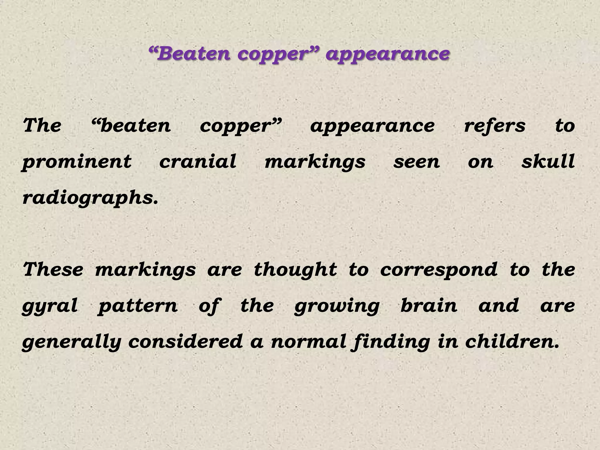 Classical signs in oral and maxillofacial radiology.pptx