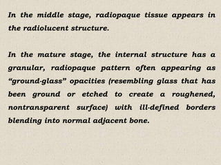 Classical signs in oral and maxillofacial radiology.pptx