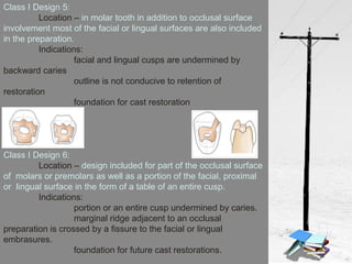 Class I Design 5:
Location – in molar tooth in addition to occlusal surface
involvement most of the facial or lingual surfaces are also included
in the preparation.
Indications:
facial and lingual cusps are undermined by
backward caries
outline is not conducive to retention of
restoration
foundation for cast restoration
Class I Design 6:
Location – design included for part of the occlusal surface
of molars or premolars as well as a portion of the facial, proximal
or lingual surface in the form of a table of an entire cusp.
Indications:
portion or an entire cusp undermined by caries.
marginal ridge adjacent to an occlusal
preparation is crossed by a fissure to the facial or lingual
embrasures.
foundation for future cast restorations.
 
