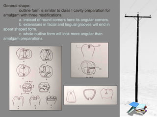 General shape:
outline form is similar to class I cavity preparation for
amalgam with three modifications,
a. instead of round corners here its angular corners.
b. extensions in facial and lingual grooves will end in
spear shaped form.
c. whole outline form will look more angular than
amalgam preparations.
 