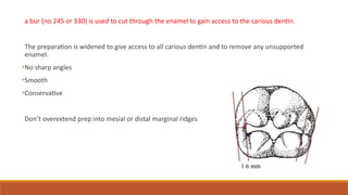a bur (no 245 or 330) is used to cut through the enamel to gain access to the carious dentin.
The preparation is widened to give access to all carious dentin and to remove any unsupported
enamel.
•No sharp angles
•Smooth
•Conservative
Don’t overextend prep into mesial or distal marginal ridges
 