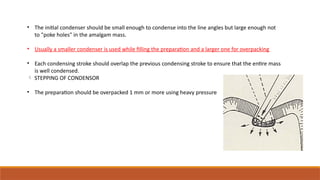 • The initial condenser should be small enough to condense into the line angles but large enough not
to "poke holes" in the amalgam mass.
• Usually a smaller condenser is used while filling the preparation and a larger one for overpacking
• Each condensing stroke should overlap the previous condensing stroke to ensure that the entire mass
is well condensed.
 STEPPING OF CONDENSOR
• The preparation should be overpacked 1 mm or more using heavy pressure
 