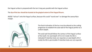 the lingual surface is prepared with the bur's long axis parallel with the lingual surface
The tip of the bur should be located at the gingival extent of the lingual fissure.
AVOID "roll out" onto the lingual surface, because this could "round over" or damage the cavosurface
margin.
The facial inclination of the bur must be altered as the cutting
progresses to establish the axial wall of the lingual portion at a
uniform depth.
The axial wall should follow the contour of the lingual surface
of the tooth. An axial depth of 0.5 mm inside the DEJ is
indicated if retentive locks are required; an axial depth of 0.2
inside the DEJ is permissible if retentive locks are not required.
 