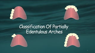 Edentulous Class Rpd classifctn of RPD .pptx