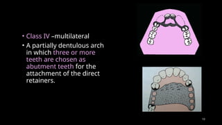 classifctn of RPD .pptx