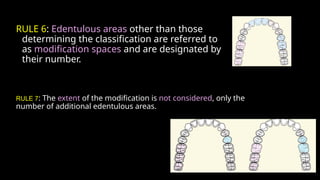 classifctn of RPD .pptx