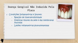 Parte 2 - Classificação e Etiologia das Doenças Periodontais e Peri ...