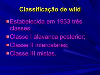 Classificação de wild Estabelecida em 1933 três classes: Classe I alavanca posterior; Classe II intercalares; Classe III mistas. 