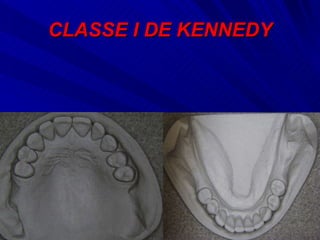 CLASSE I DE KENNEDY 