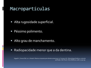 Macropartículas

 Alta rugosidade superficial.

 Péssimo polimento.

 Alto grau de manchamento.

 Radiopacidade menor que a da dentina.

  Higashi C, Souza CM, Liu J, Hirata R. Resina composta para dentes anteriores. In: Fonseca AS. Odontologia Estética: a arte da
                                                                         perfeição. São Paulo: Artes Médicas; 2008. p. 99-135.
 