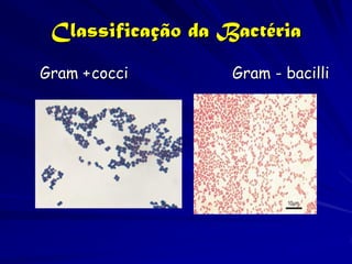 Classificação da Bactéria
Gram + cocci       Gram - bacilli
 