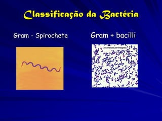 Classificação da Bactéria

Gram - Spirochete   Gram + bacilli
 