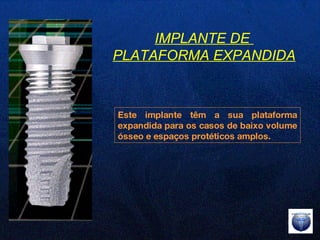 Este implante têm a sua plataforma expandida para os casos de baixo volume ósseo e espaços protéticos amplos. IMPLANTE DE  PLATAFORMA EXPANDIDA 