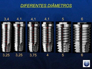 DIFERENTES DIÂMETROS M i c r o m i n i M i n i Regu L ar Larga Regu L ar Larga 3,4 3,25 4,1 3,25 4,1 3,75 4,1 4 5 5 6 6 