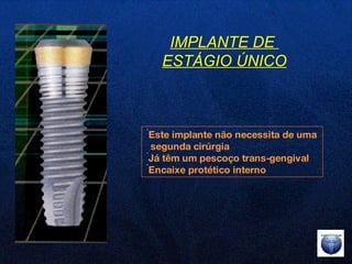Este implante não necessita de uma  segunda cirúrgia Já têm um pescoço trans-gengival Encaixe protético interno IMPLANTE DE  ESTÁGIO ÚNICO 
