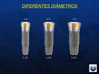 DIFERENTES DIÂMETROS 3.25  4.00  5.00 4.8  4.8  4.8  
