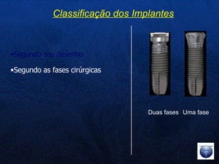 Segundo seu desenho Segundo as fases cirúrgicas Classificação dos Implantes Duas fases Uma fase 