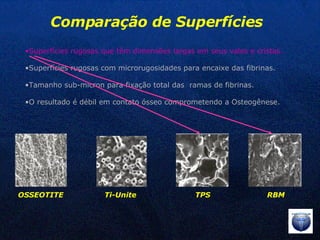 OSSEOTITE Ti-Unite TPS RBM Comparação de Superfícies Superfícies rugosas que têm dimensões largas em seus vales e cristas. Superfícies rugosas com microrugosidades para encaixe das fibrinas. Tamanho sub-micron para fixação total das  ramas de fibrinas. O resultado é débil em contato ósseo comprometendo a Osteogênese. 