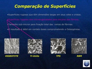 OSSEOTITE Ti-Unite TPS RBM Comparação de Superfícies Superficies rugosas que têm dimensões largas em seus vales e cristas. Superficies rugosas com microrugosidades para encaixe das fibrinas. Tamanho sub-micron para fixação total das  ramas de fibrinas. O resultado é débil em contato ósseo comprometendo a Osteogénese. 