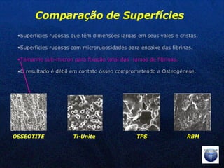 OSSEOTITE Ti-Unite TPS RBM Comparação de Superfícies Superficies rugosas que têm dimensões largas em seus vales e cristas. Superficies rugosas com microrugosidades para encaixe das fibrinas. Tamanho sub-micron para fixação total das  ramas de fibrinas. O resultado é débil em contato ósseo comprometendo a Osteogénese. 