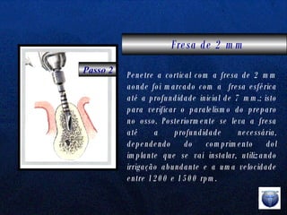 Passo 2 Fresa de 2 mm   Penetre a cortical com a fresa de 2 mm aonde foi marcado com a  fresa esférica até a profundidade inicial de 7 mm.; isto para verificar o paralelismo do preparo no osso. Posteriormente se leva a fresa até a profundidade necessária, dependendo do comprimento dol implante que se vai instalar, utilizando irrigação abundante e a uma velocidade entre 1200 e 1500 rpm. 
