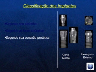 Segundo seu desenho Segundo as fases cirúrgicas Segundo sua conexão protética Classificação dos Implantes Cone  Morse Hexágono  Externo 