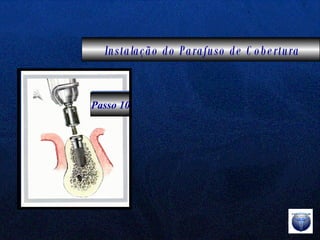 Instalação do Parafuso de Cobertura Passo 10 