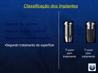 Segundo seu desenho Segundo as fases cirúrgicas Segundo sua conexão protética Segundo tratamento de superfície Classificação dos Implantes Ti puro sem tratamento Ti puro com  tratamento 