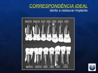 CORRESPONDÊNCIA IDEAL dente a restaurar-implante 