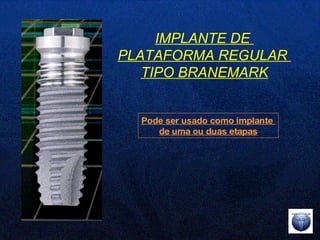 Pode ser usado como implante  de uma ou duas etapas IMPLANTE DE  PLATAFORMA REGULAR  TIPO BRANEMARK 