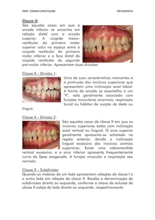 PROF. EDMAR CHRISTOVAM                                 ORTODONTIA


Classe II:
São aqueles casos em que a
arcada inferior se encontra em
relação distal com a arcada
superior.   A    cúspide    mesio-
vestibular do primeiro molar
superior oclui no espaço entre a
cúspide vestibular do primeiro
molar inferior e a face distal da
cúspide vestibular do segundo
pré-molar inferior. Apresentam duas divisões:

Classe II – Divisão 1:
                         Uma de suas características marcantes é
                         a protrusão dos incisivos superiores que
                         apresentam uma inclinação axial labial.
                         A forma da arcada se assemelha à um
                         "V", está geralmente associada com
                         funções musculares anormais, respiração
                         bucal ou hábitos de sucção de dedo ou
língua.

Classe II – Divisão 2:
                       São aqueles casos de classe II em que os
                       incisivos superiores estão com inclinação
                       axial vertical ou lingual. O arco superior
                       geralmente apresenta-se achatado na
                       região anterior, devido a inclinação
                       lingual excessiva dos incisivos centrais
                       superiores. Existe uma sobremordida
vertical excessiva, e o arco inferior apresenta frequentemente
curva de Spee exagerada. A função muscular e respiração são
normais.

Classe II – Subdivisão:
Quando os molares de um lado apresentam relações de classe I e
o outro lado em relação de classe II. Recebe a denominação de
subdivisões direita ou esquerda, conforme a chave de oclusão de
classe II esteja do lado direito ou esquerdo, respectivamente.
 