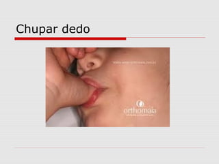 Chupar dedo
 