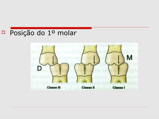  Posição do 1º molar
 