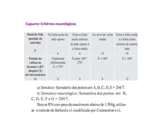 Capurro: Critérios neurológicos 
 