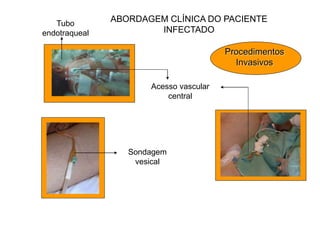 ABORDAGEM CLÍNICA DO PACIENTE
INFECTADO
Procedimentos
Invasivos
Tubo
endotraqueal
Acesso vascular
central
Sondagem
vesical
 