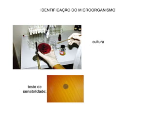 teste de
sensibilidade:
cultura
IDENTIFICAÇÃO DO MICROORGANISMO
 