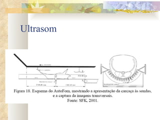 Ultrasom 