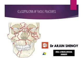 CLASSIFICATION OF FACIAL FRACTURES
 