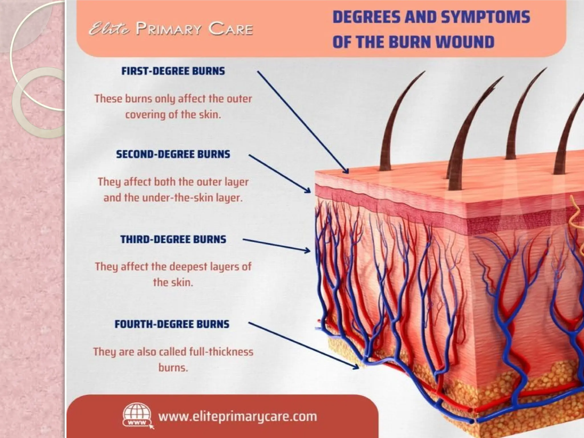 ANATOMY AND PHYSIOLOGY TOPIC ON INTEGUMENTARY SYSTEM;CLASSIFICATION-OF ...