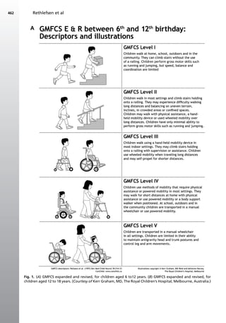 Classification of-cerebral-palsy