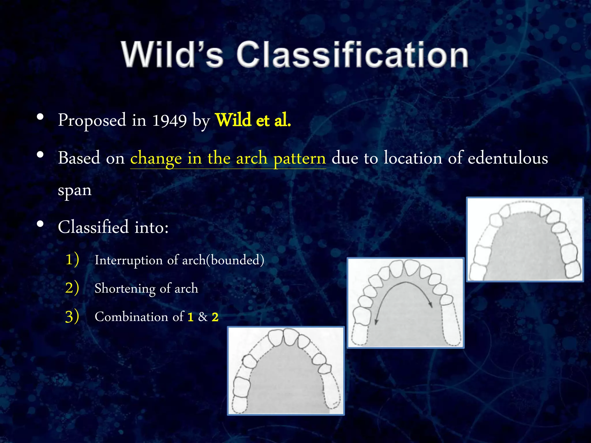 • Proposed in 1949 by Wild et al.
• Based on change in the arch pattern due to location of edentulous
span
• Classified into:
1) Interruption of arch(bounded)
2) Shortening of arch
3) Combination of 1 & 2
 
