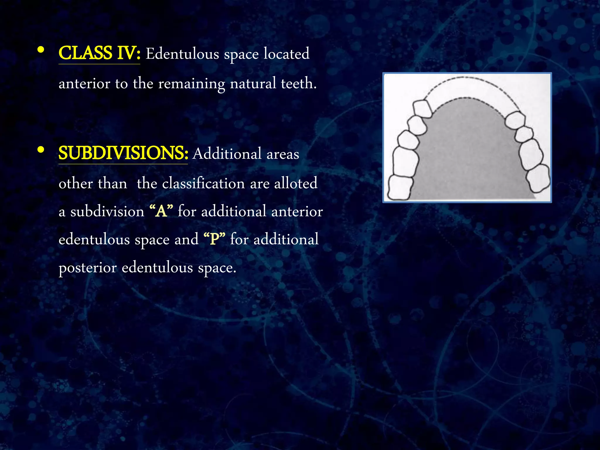 • CLASS IV: Edentulous space located
anterior to the remaining natural teeth.
• SUBDIVISIONS: Additional areas
other than the classification are alloted
a subdivision “A” for additional anterior
edentulous space and “P” for additional
posterior edentulous space.
 