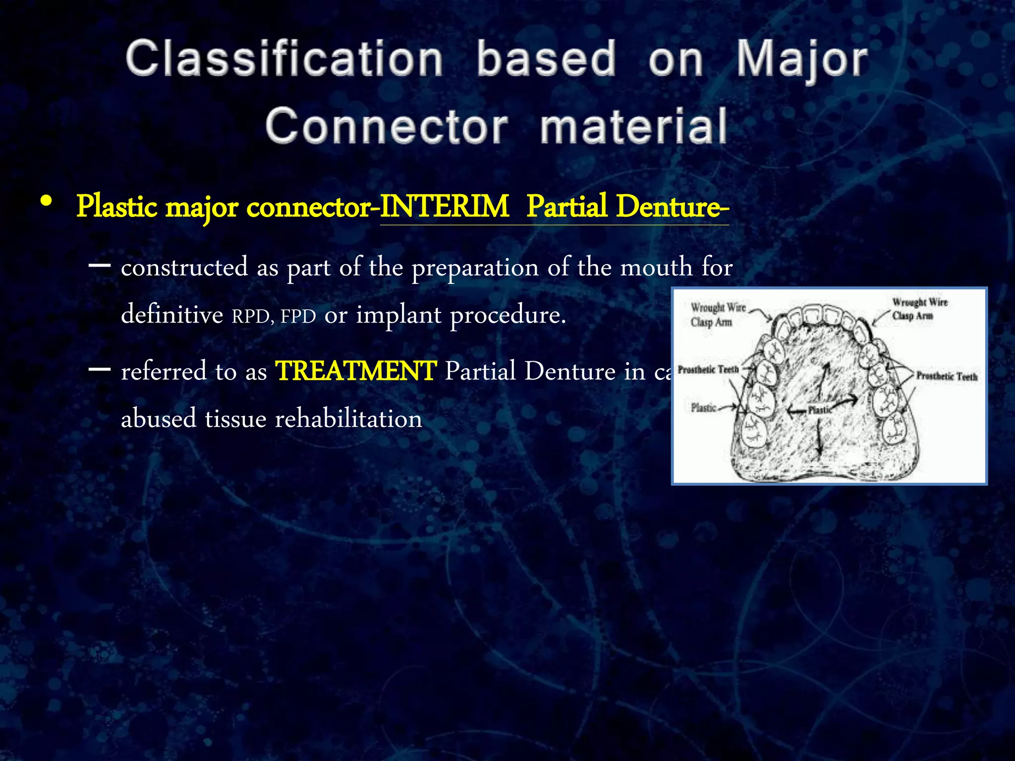 • Plastic major connector-INTERIM Partial Denture-
– constructed as part of the preparation of the mouth for
definitive RPD, FPD or implant procedure.
– referred to as TREATMENT Partial Denture in case of
abused tissue rehabilitation
 