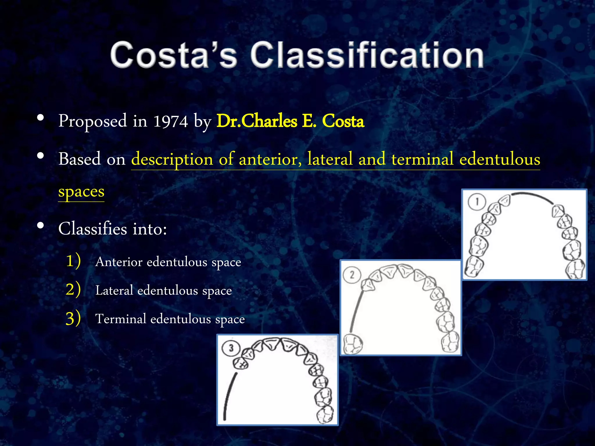 • Proposed in 1974 by Dr.Charles E. Costa
• Based on description of anterior, lateral and terminal edentulous
spaces
• Classifies into:
1) Anterior edentulous space
2) Lateral edentulous space
3) Terminal edentulous space
 