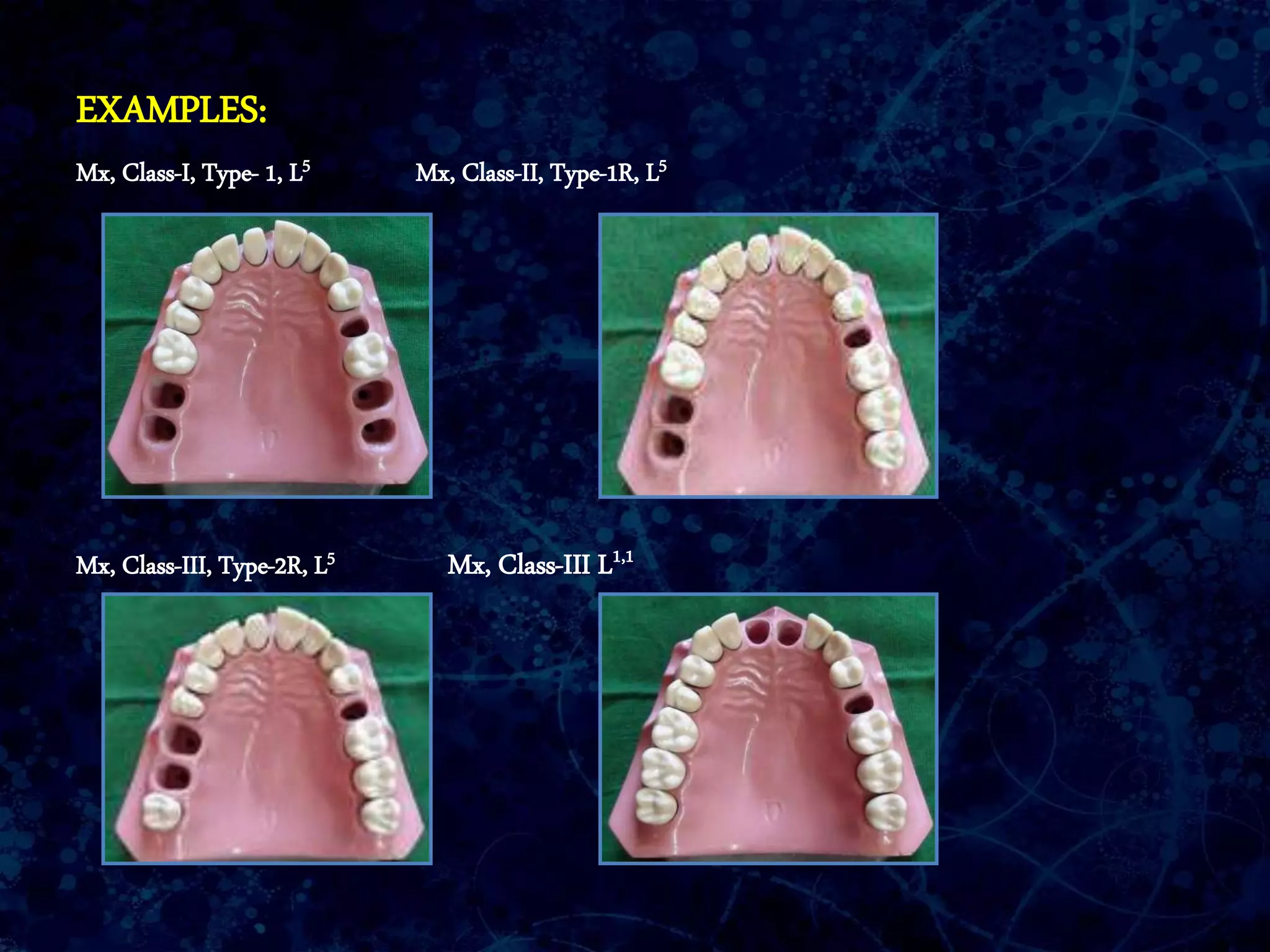 EXAMPLES:
Mx, Class-I, Type- 1, L5 Mx, Class-II, Type-1R, L5
Mx, Class-III, Type-2R, L5 Mx, Class-III L1,1
 